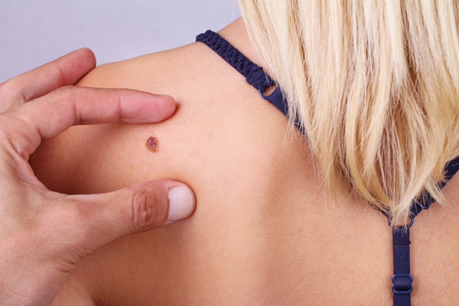 Kaj morate vedeti o dermatologiji v Ljubljani: vodič za začetnike